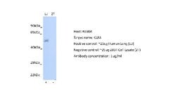 CLK4 Antibody, Novus Biologicals 100 &mu;L; Unconjugated:Antibodies, Polyclonal